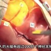 梦见自己死去了预示什么